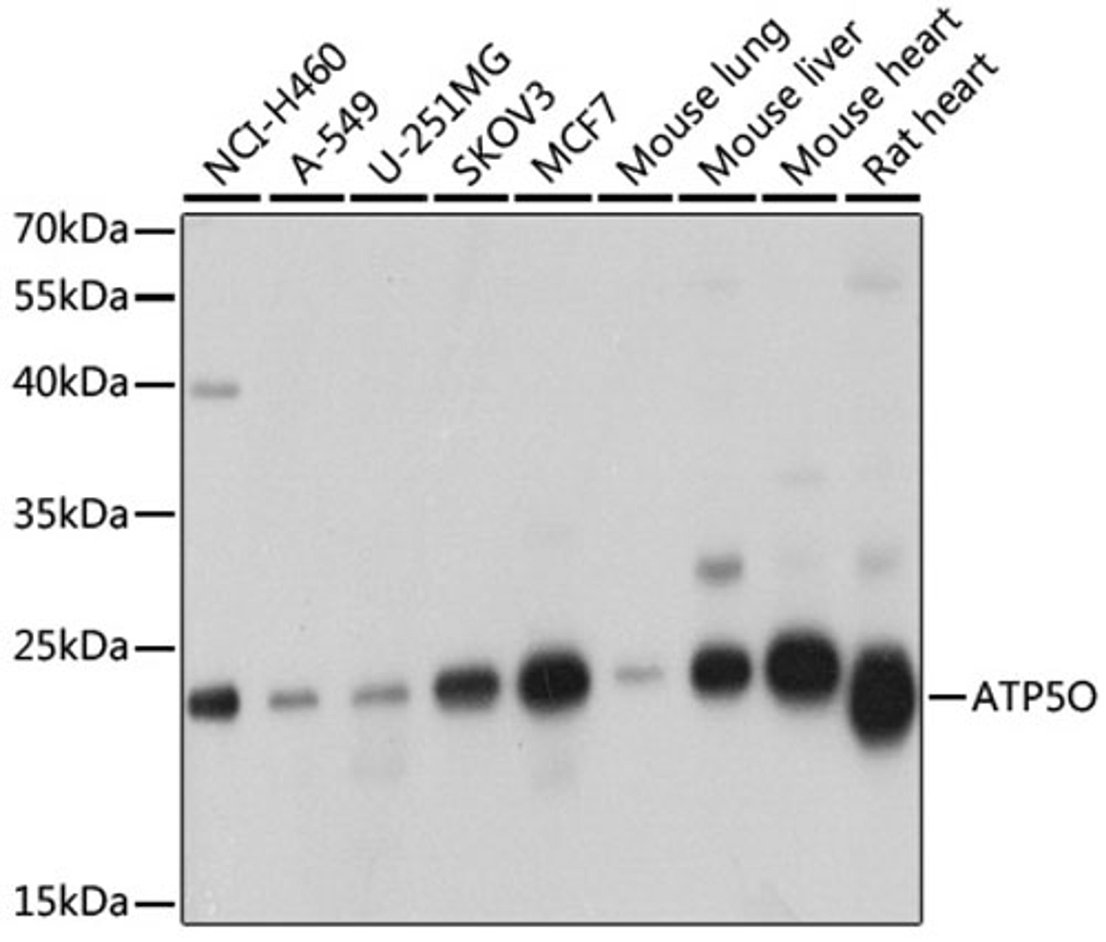 Western blot - ATP5O antibody (A8103)