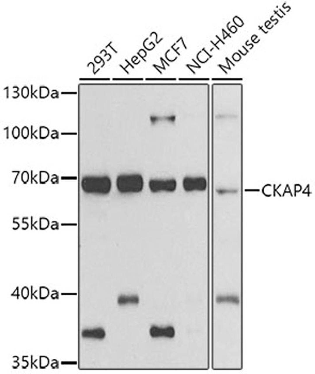 Western blot - CKAP4 antibody (A7777)