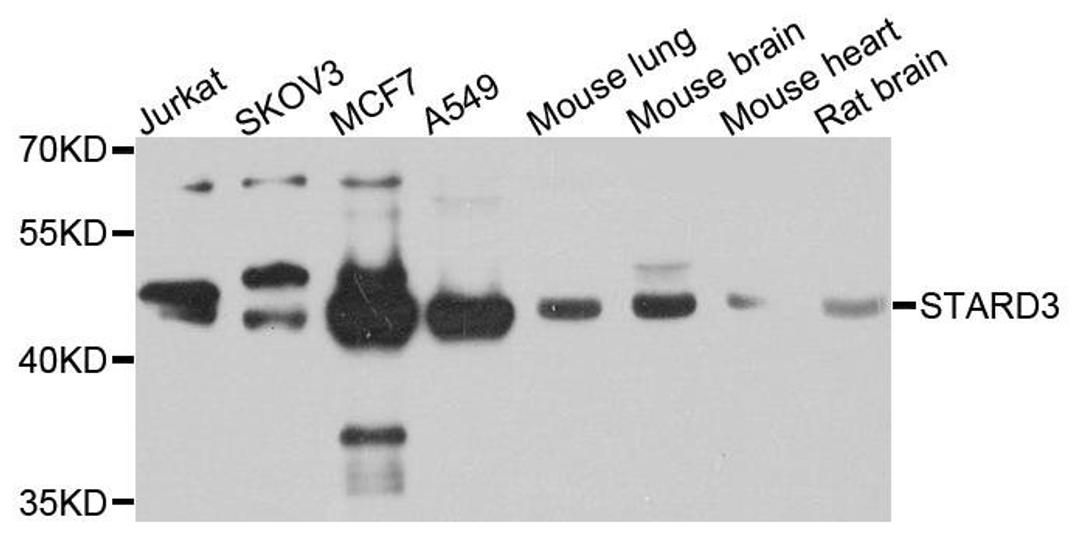 Western blot analysis of extracts of various cells using STARD3 antibody