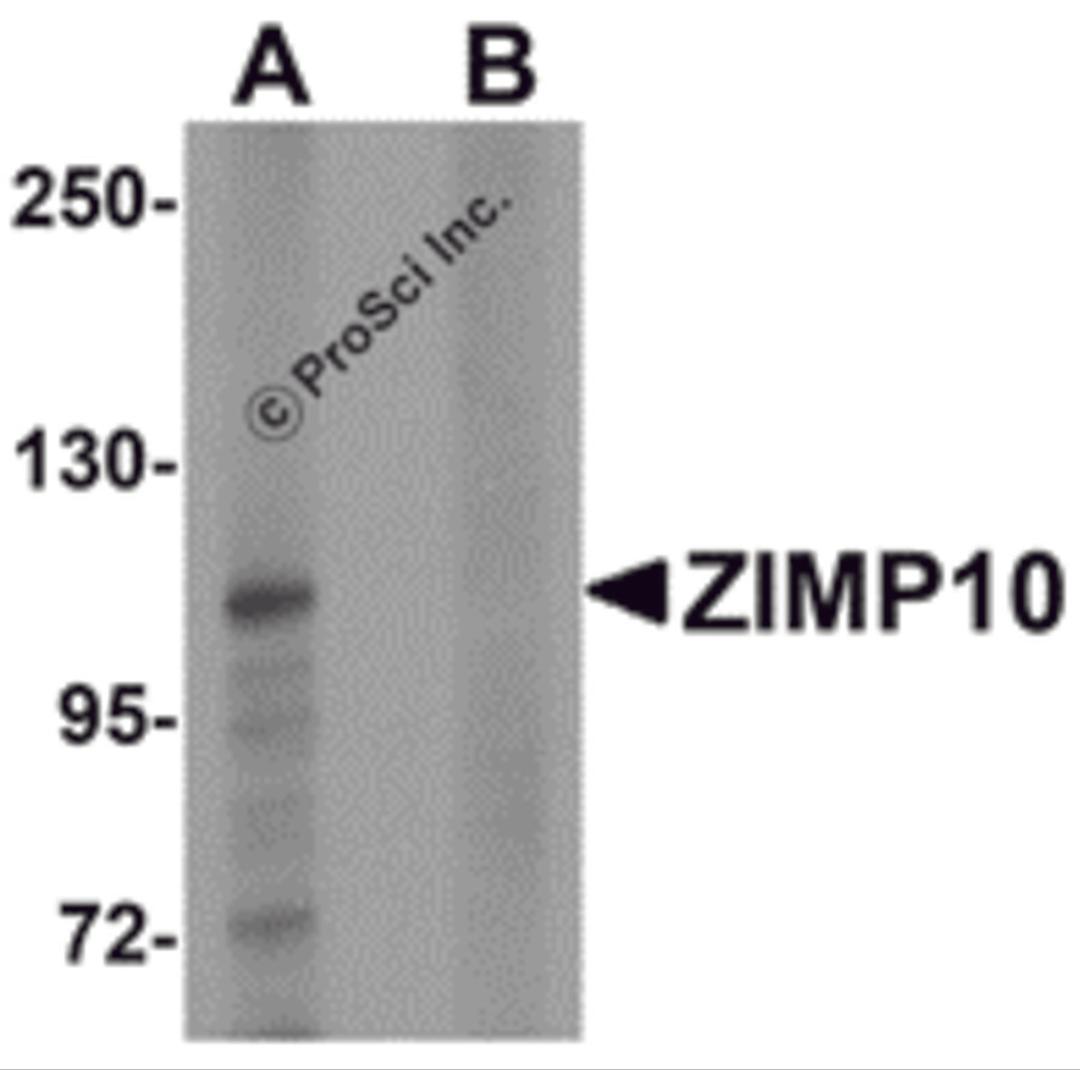 Western blot analysis of ZIMP10 in K562 cell lysate with ZIMP10 antibody at 0.5 &#956;g/mL in (A) the absence and (B) the presence of blocking peptide