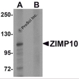 Western blot analysis of ZIMP10 in K562 cell lysate with ZIMP10 antibody at 0.5 μg/mL in (A) the absence and (B) the presence of blocking peptide