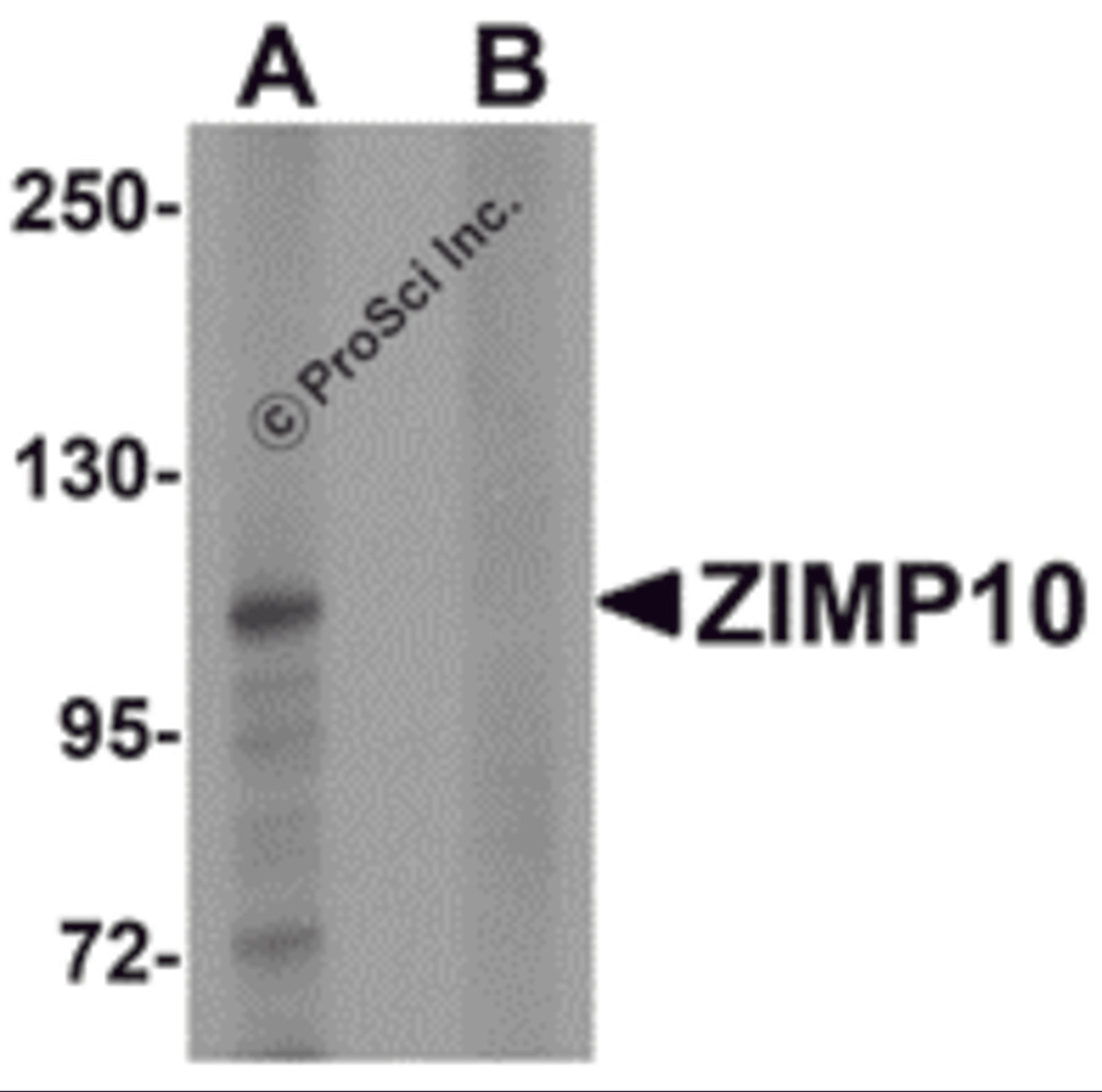 Western blot analysis of ZIMP10 in K562 cell lysate with ZIMP10 antibody at 0.5 μg/mL in (A) the absence and (B) the presence of blocking peptide
