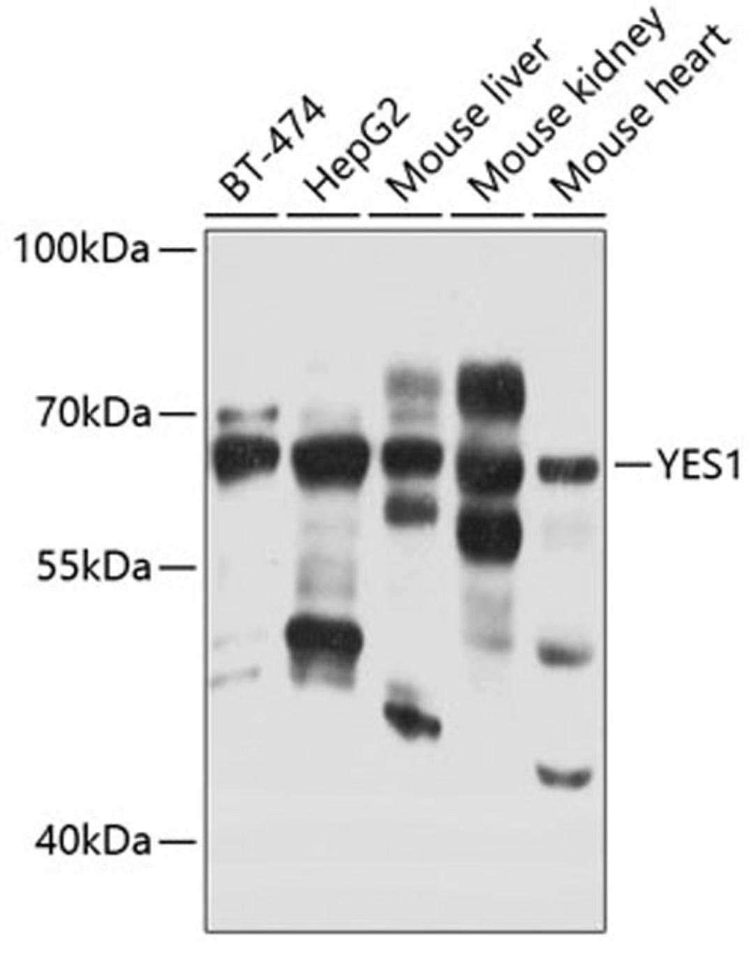 Western blot - YES1 antibody (A0628)