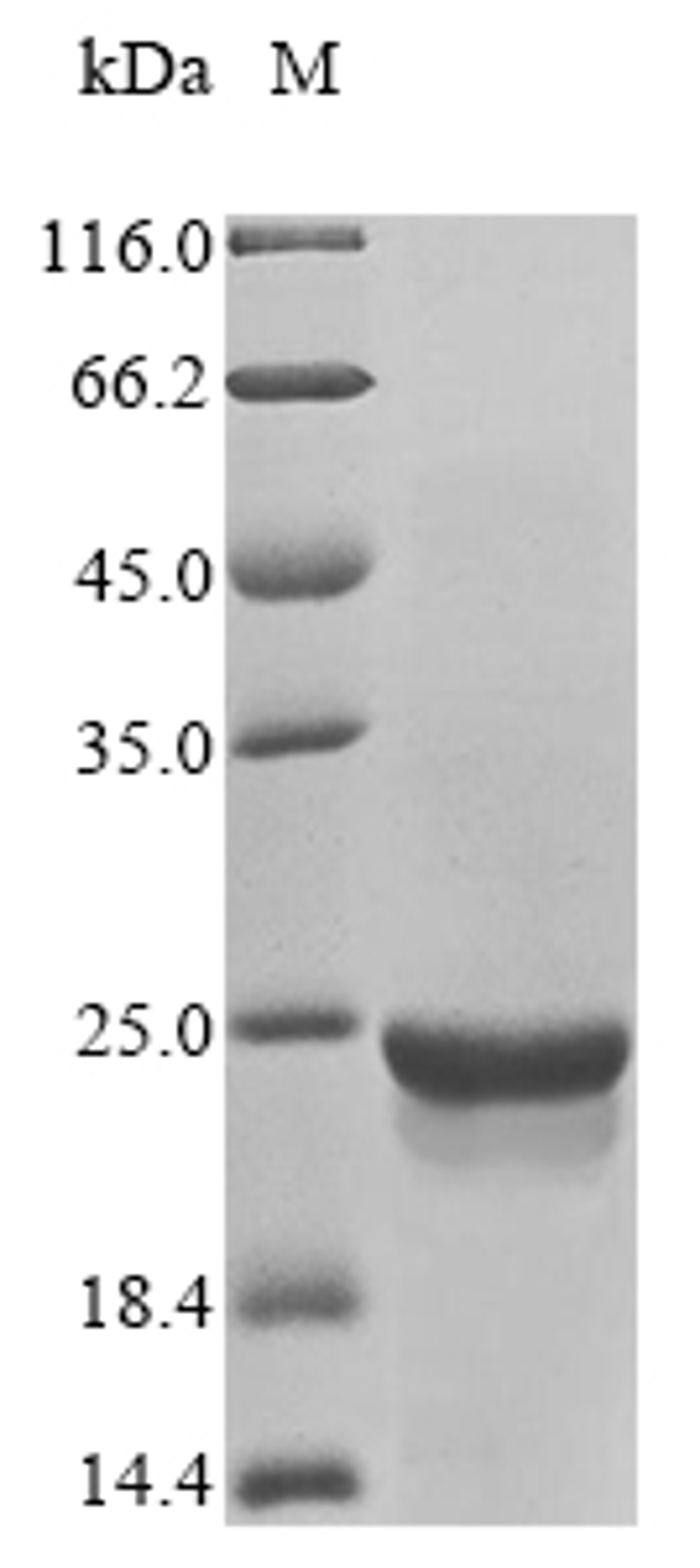 (Tris-Glycine gel) Discontinuous SDS-PAGE (reduced) with 5% enrichment gel and 15% separation gel.