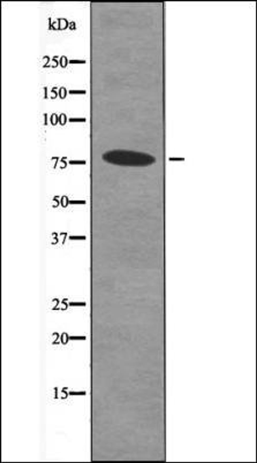 Western blot analysis of MDA-MB-435 whole cell lysates using Bcl-6 -Phospho-Ser343- antibody