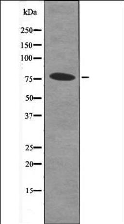 Western blot analysis of MDA-MB-435 whole cell lysates using Bcl-6 -Phospho-Ser343- antibody