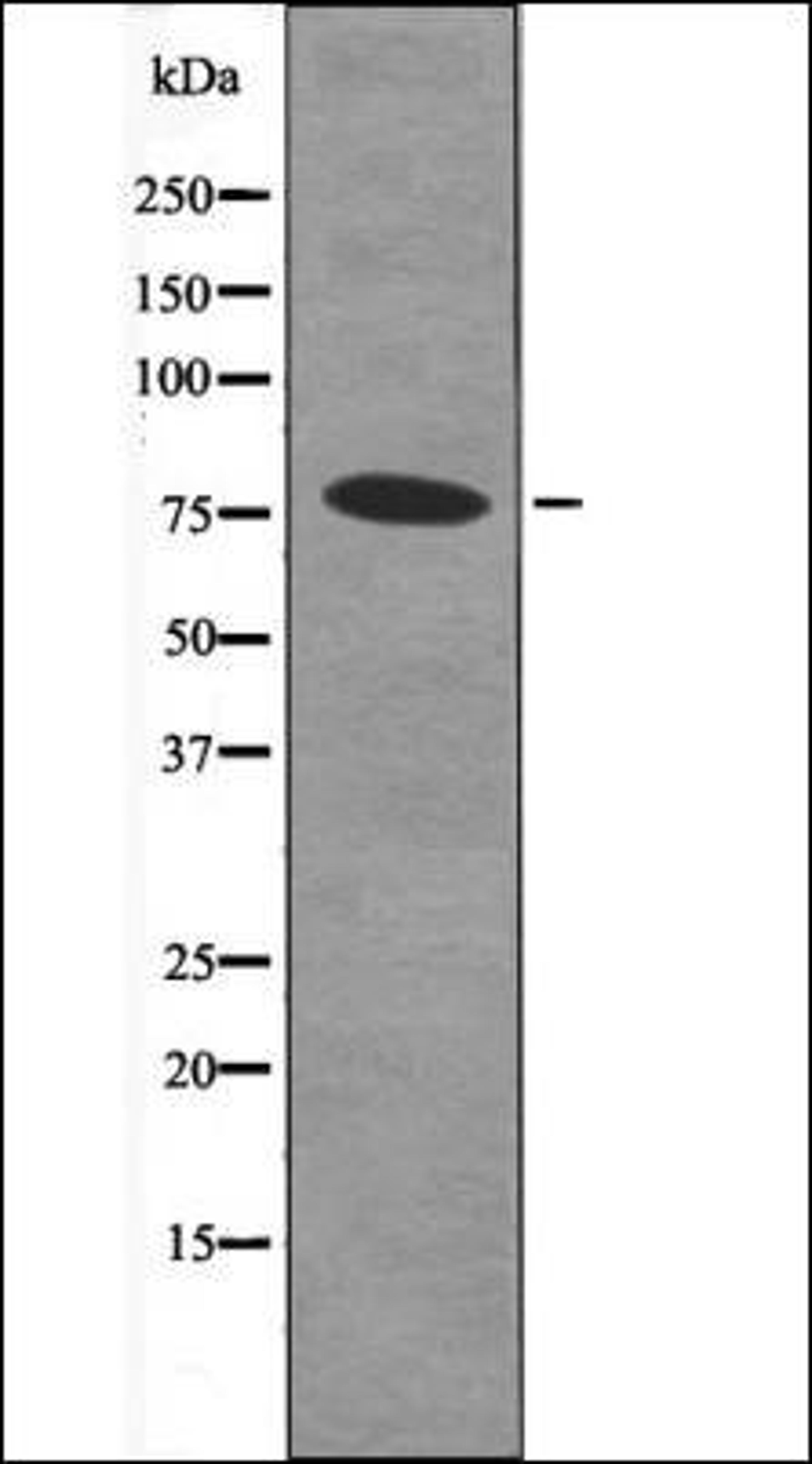 Western blot analysis of MDA-MB-435 whole cell lysates using Bcl-6 -Phospho-Ser343- antibody