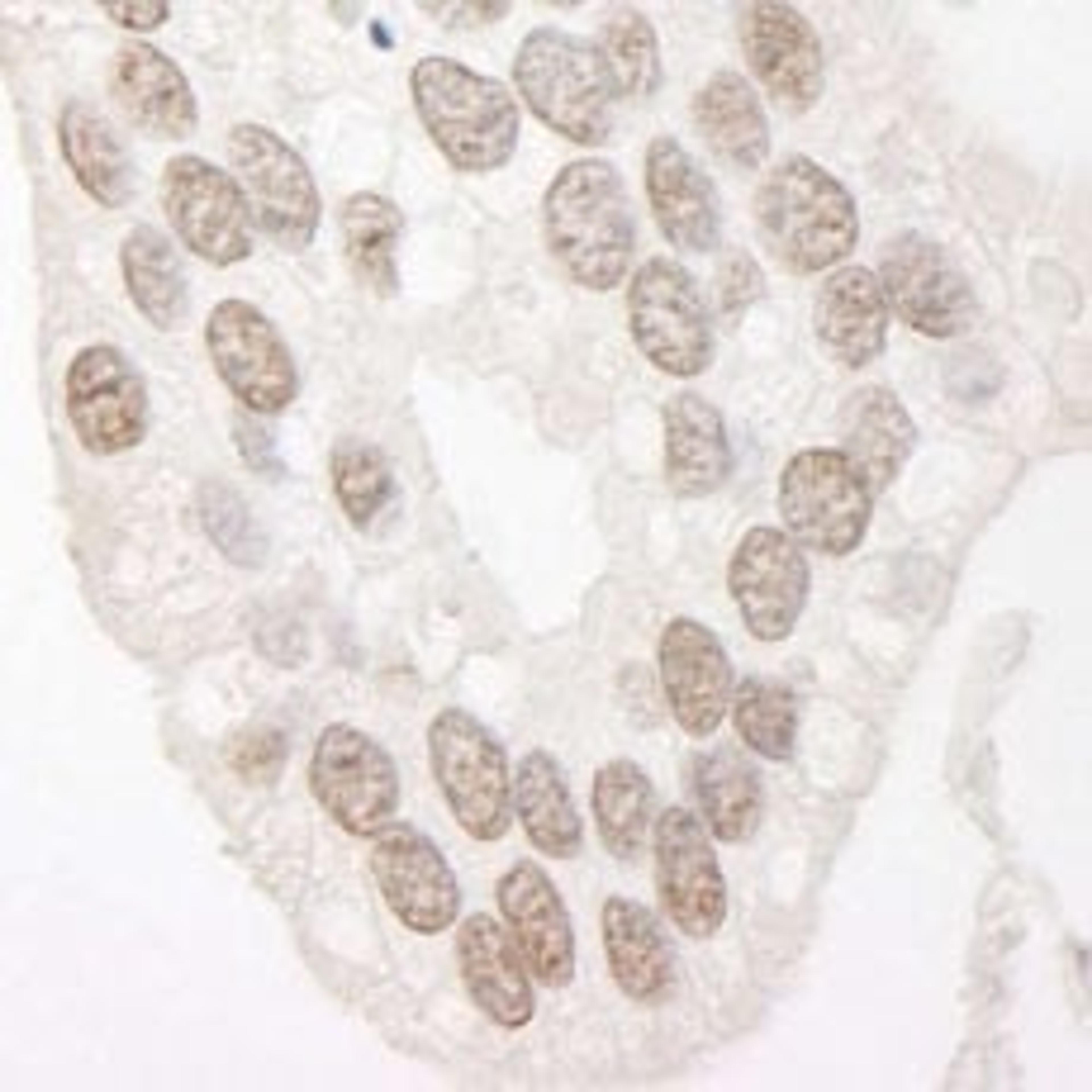 Detection of human Cyclin L1 by immunohistochemistry.