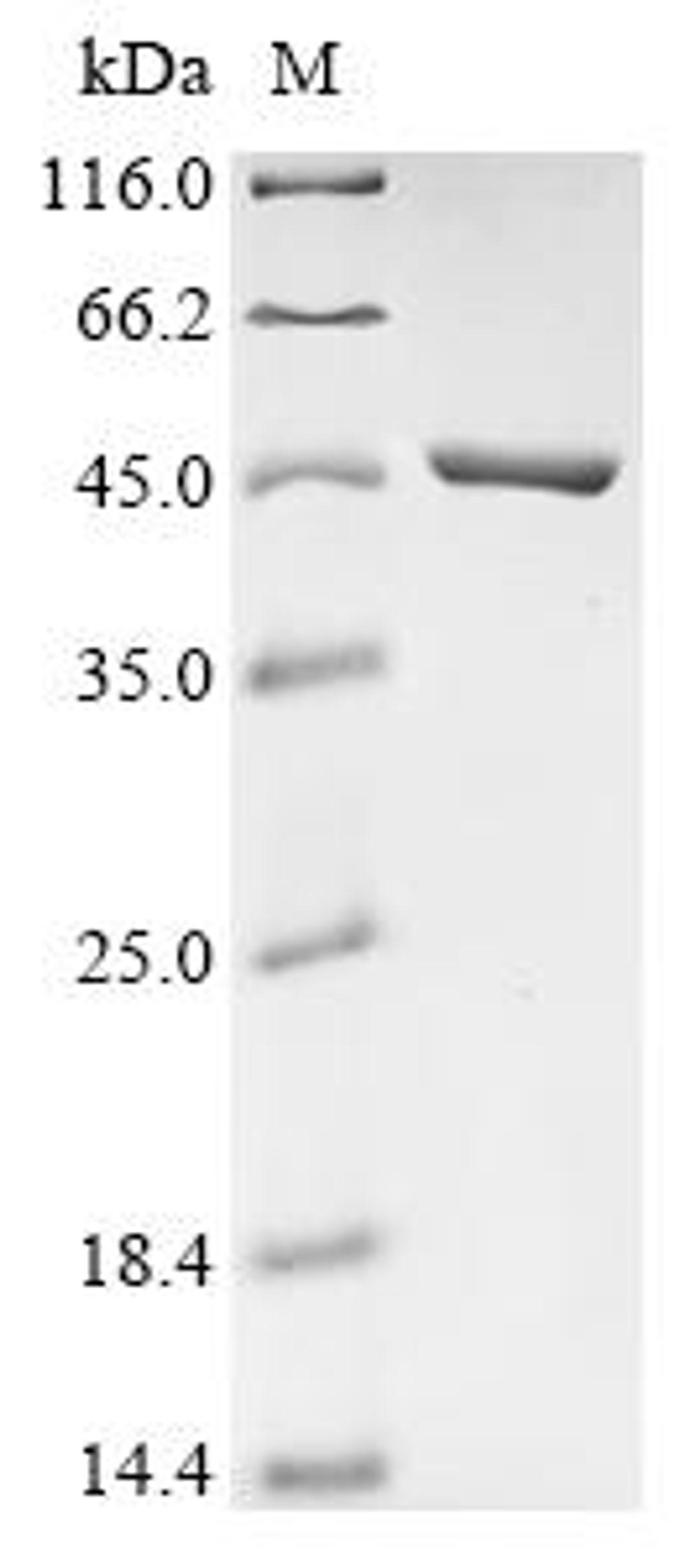 (Tris-Glycine gel) Discontinuous SDS-PAGE (reduced) with 5% enrichment gel and 15% separation gel.
