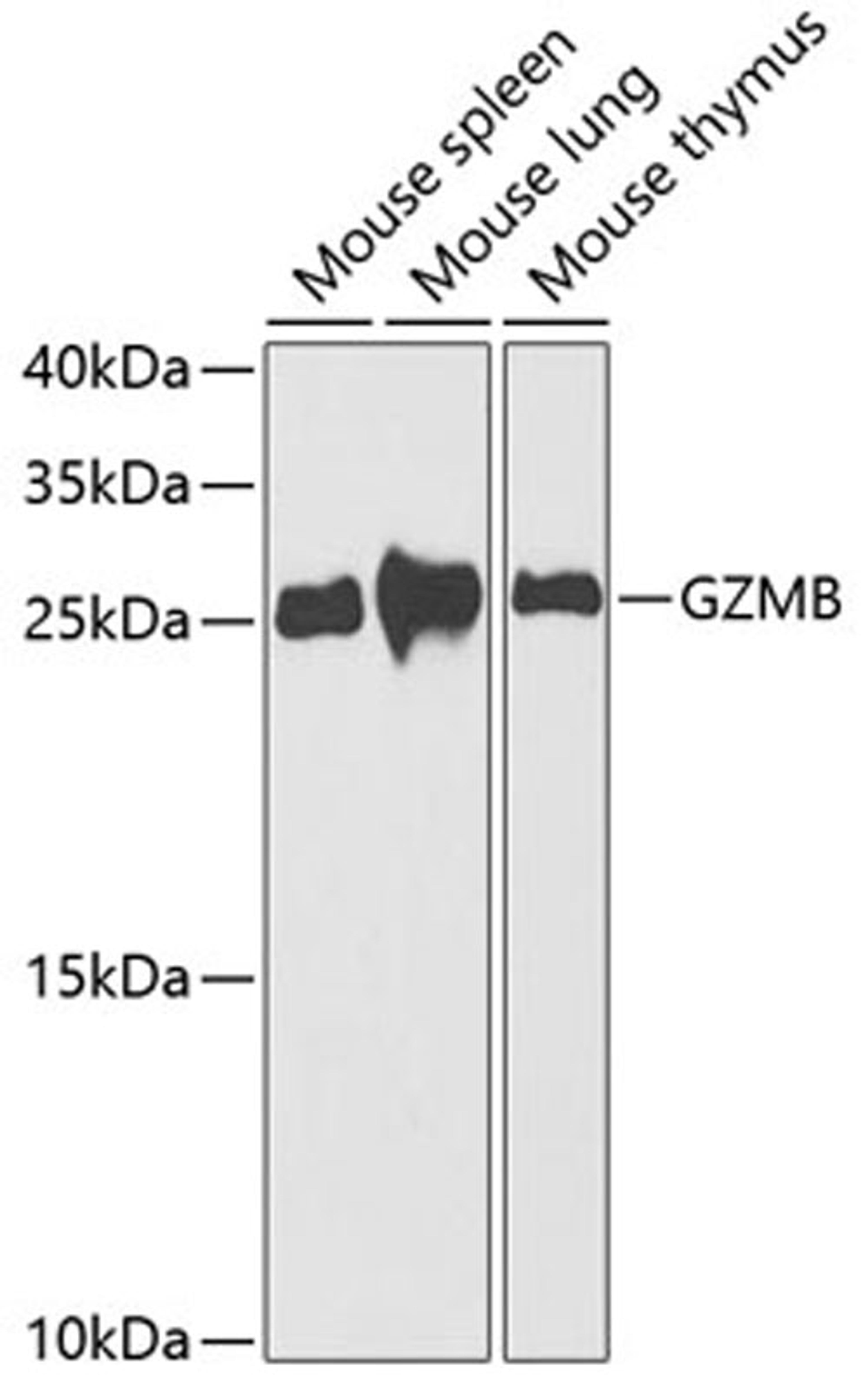 Western blot - GZMB antibody (A2557)