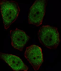 Fluorescent image of U251 cell stained with PPP1CB Antibody .U251 cells were fixed with 4% PFA (20 min), permeabilized with Triton X-100 (0.1%, 10 min), then incubated with PPP1CB primary antibody (1:25). For secondary antibody, Alexa Fluor 488 conjugated