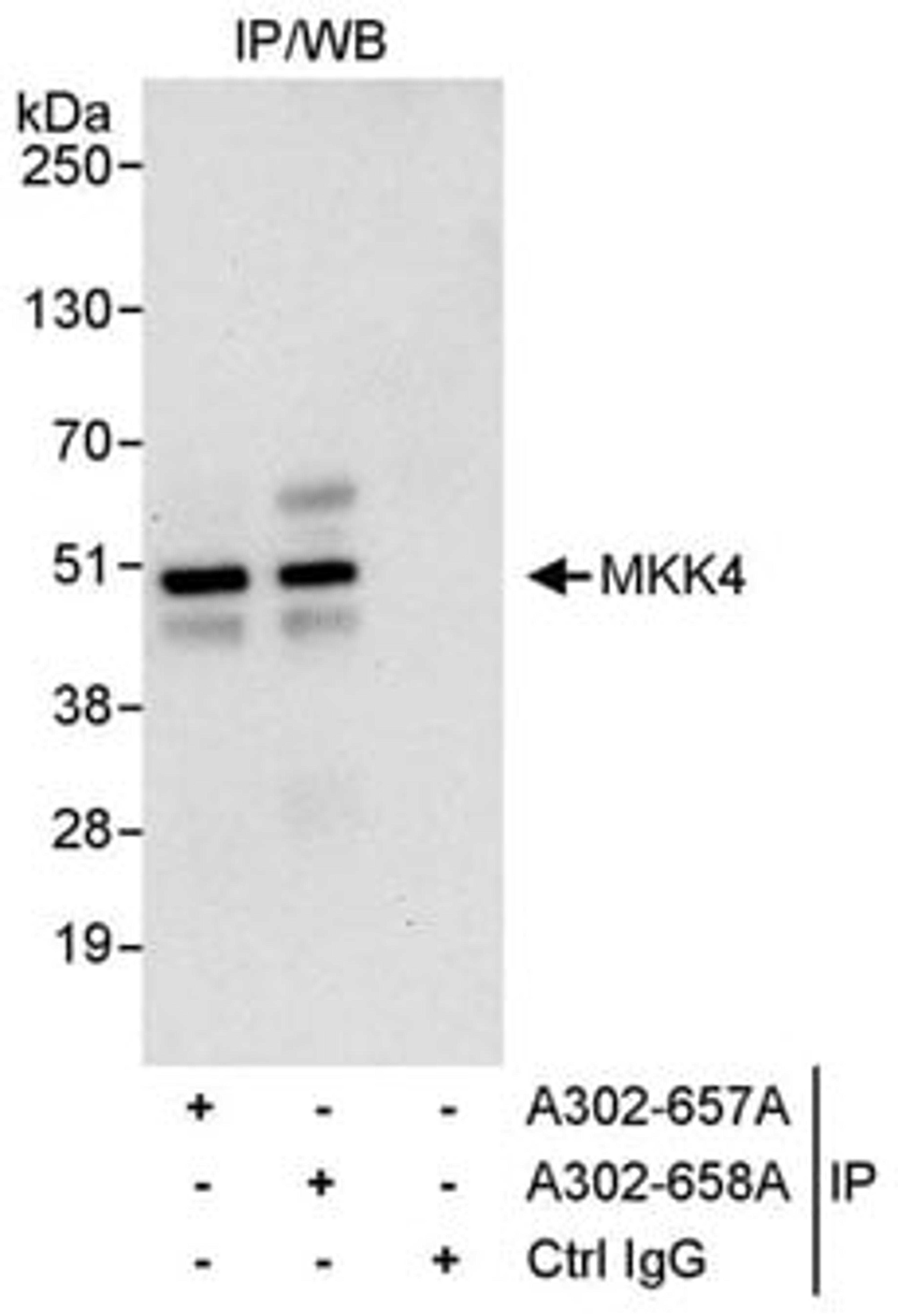 Detection of human MKK4 by western blot of immunoprecipitates.