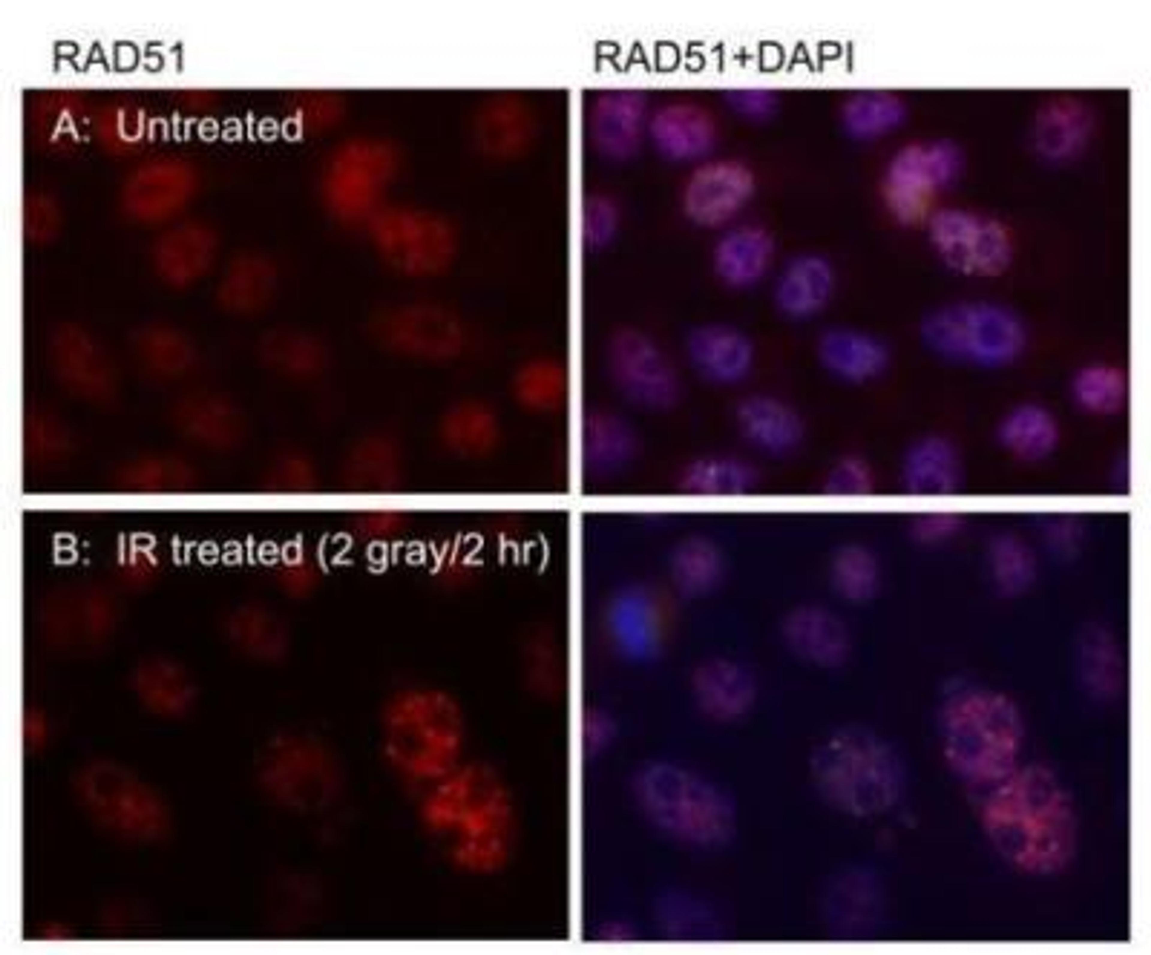 Immunocytochemistry/Immunofluorescence: Rad51 Antibody (14B4) [NB100-148] - U2OS cells