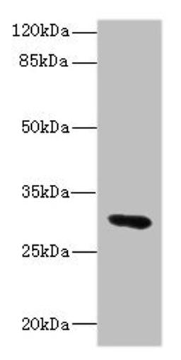 Western blot. All lanes: UPK3A antibody IgG at 1.76ug/ml + Mouse lung tissue. Secondary. Goat polyclonal to rabbit IgG at 1/10000 dilution. Predicted band size: 31, 18 kDa. Observed band size: 31 kDa. 