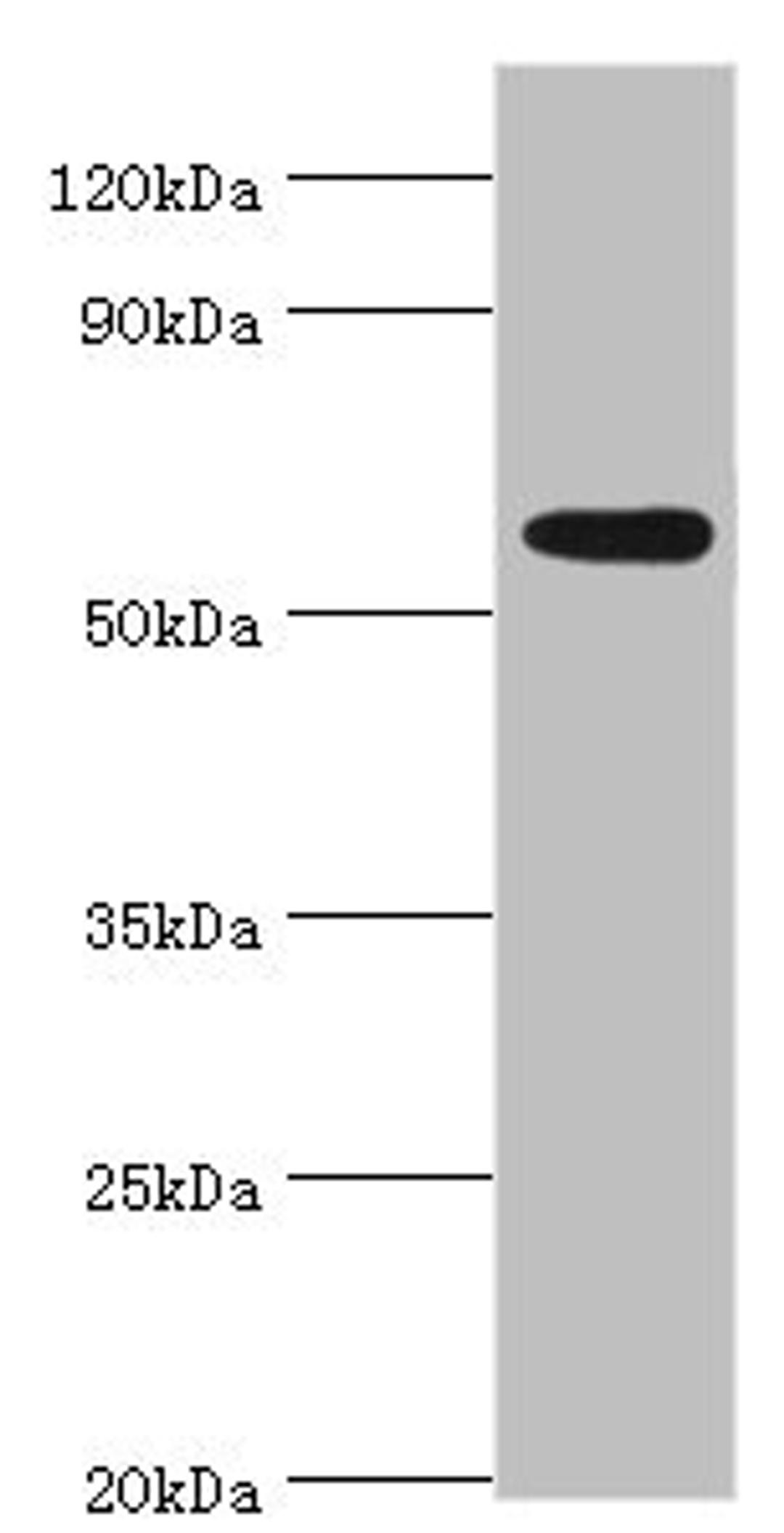 Western blot. All lanes: Poly [ADP-ribose] polymerase 3 antibody at 2ug/ml + Mouse heart tissue. Secondary. Goat polyclonal to rabbit IgG at 1/10000 dilution. Predicted band size: 60 kDa. Observed band size: 60 kDa. 