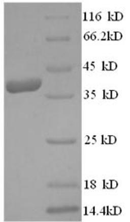 (Tris-Glycine gel) Discontinuous SDS-PAGE (reduced) with 5% enrichment gel and 15% separation gel.