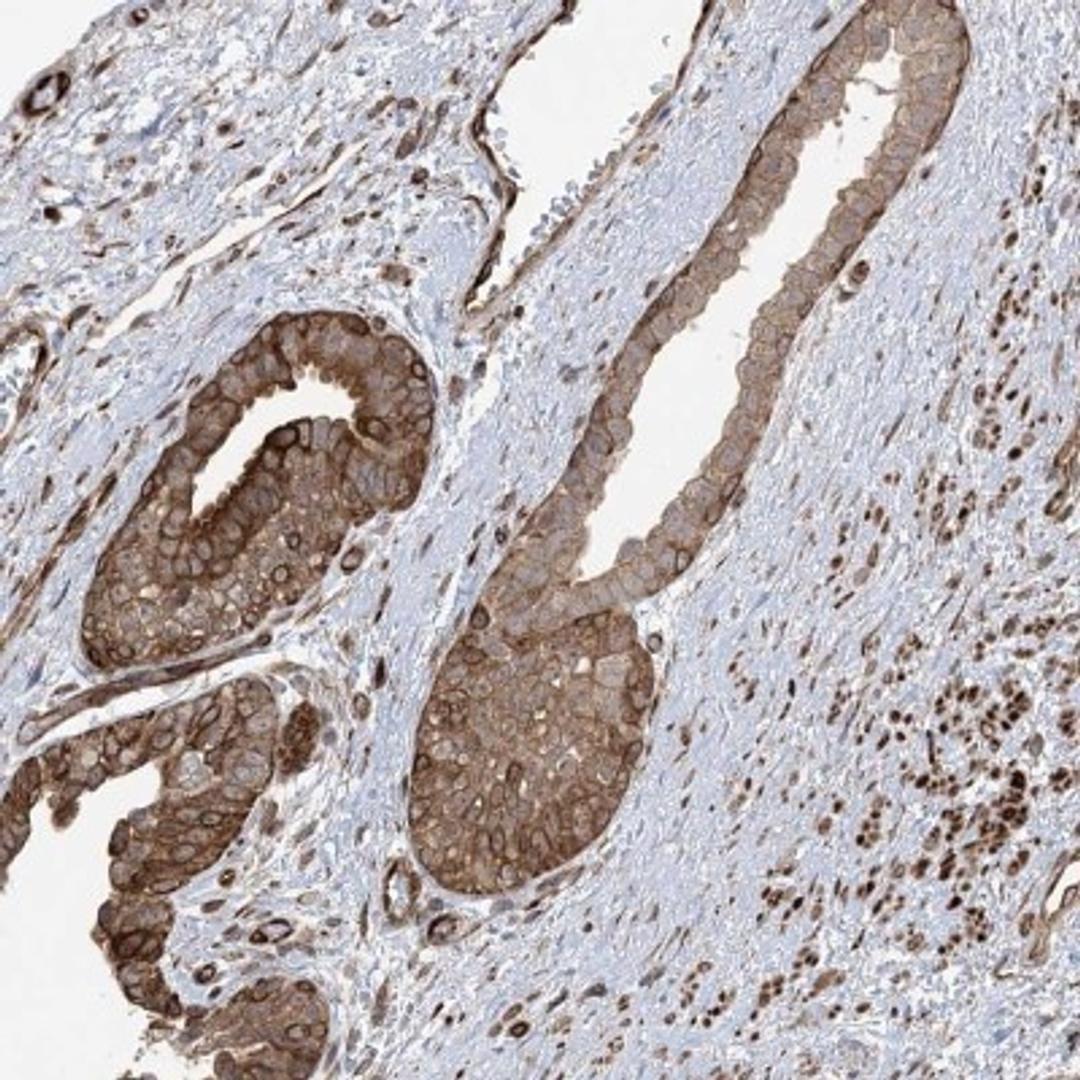 Immunohistochemistry-Paraffin: KIAA0408 Antibody [NBP2-34001] - Immunohistochemical staining of human prostate shows distinct cytoplasmic, membranous and nuclear positivity in glandular cells.