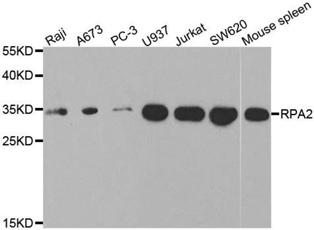 Western blot analysis of extracts of various cell lines using RPA2 antibody