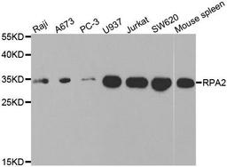 Western blot analysis of extracts of various cell lines using RPA2 antibody
