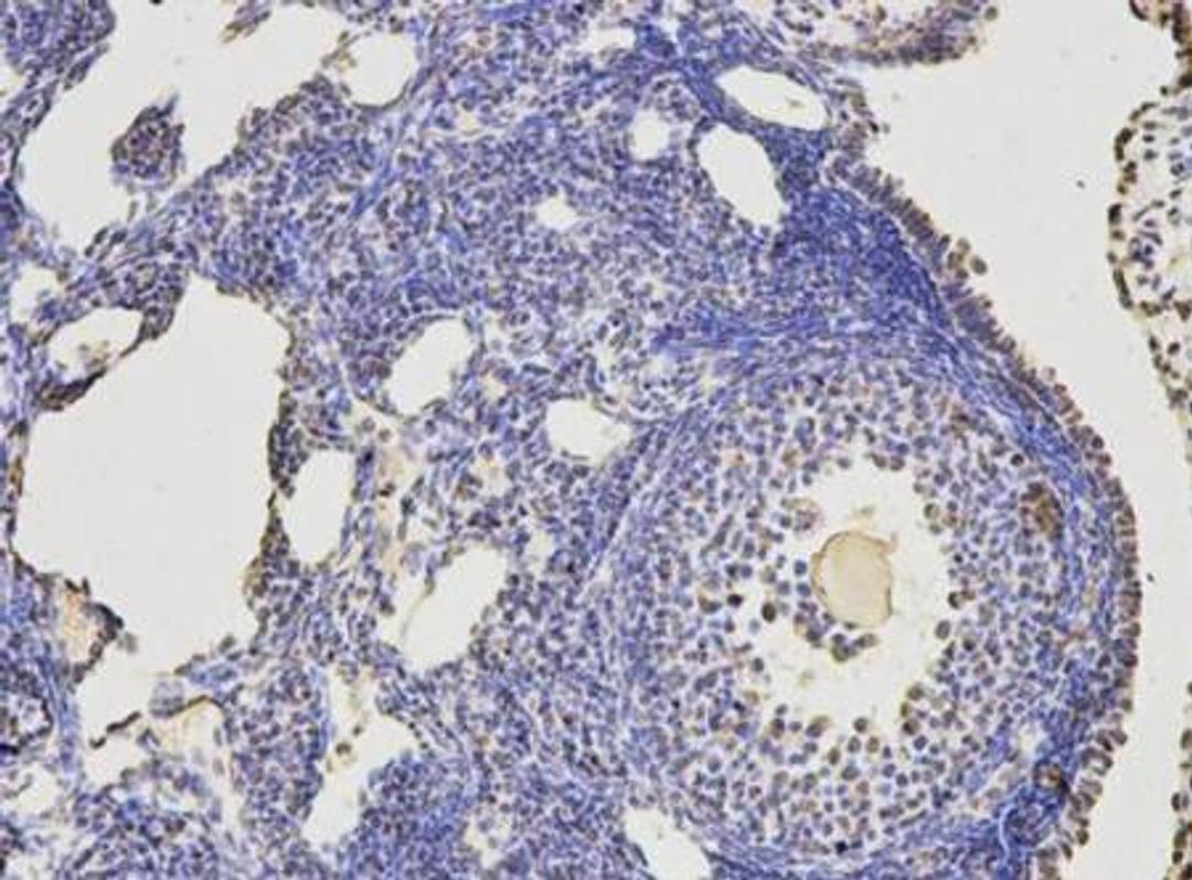 Immunohistochemical analysis of mouse ovary tissue using KLHDC3 antibody