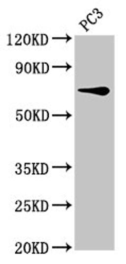 Western Blot. Positive WB detected in: PC-3 whole cell lysate. All lanes: SCNN1B antibody at 8µg/ml. Secondary. Goat polyclonal to rabbit IgG at 1/50000 dilution. Predicted band size: 73, 78 kDa. Observed band size: 73 kDa
