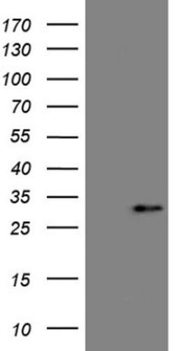 Western Blot: Angiopoietin-like protein 8/Betatrophin Antibody (1B12) [NBP2-46596] - Analysis of HEK293T cells were transfected with the pCMV6-ENTRY control (Left lane) or pCMV6-ENTRY Angiopoietin-like protein 8.