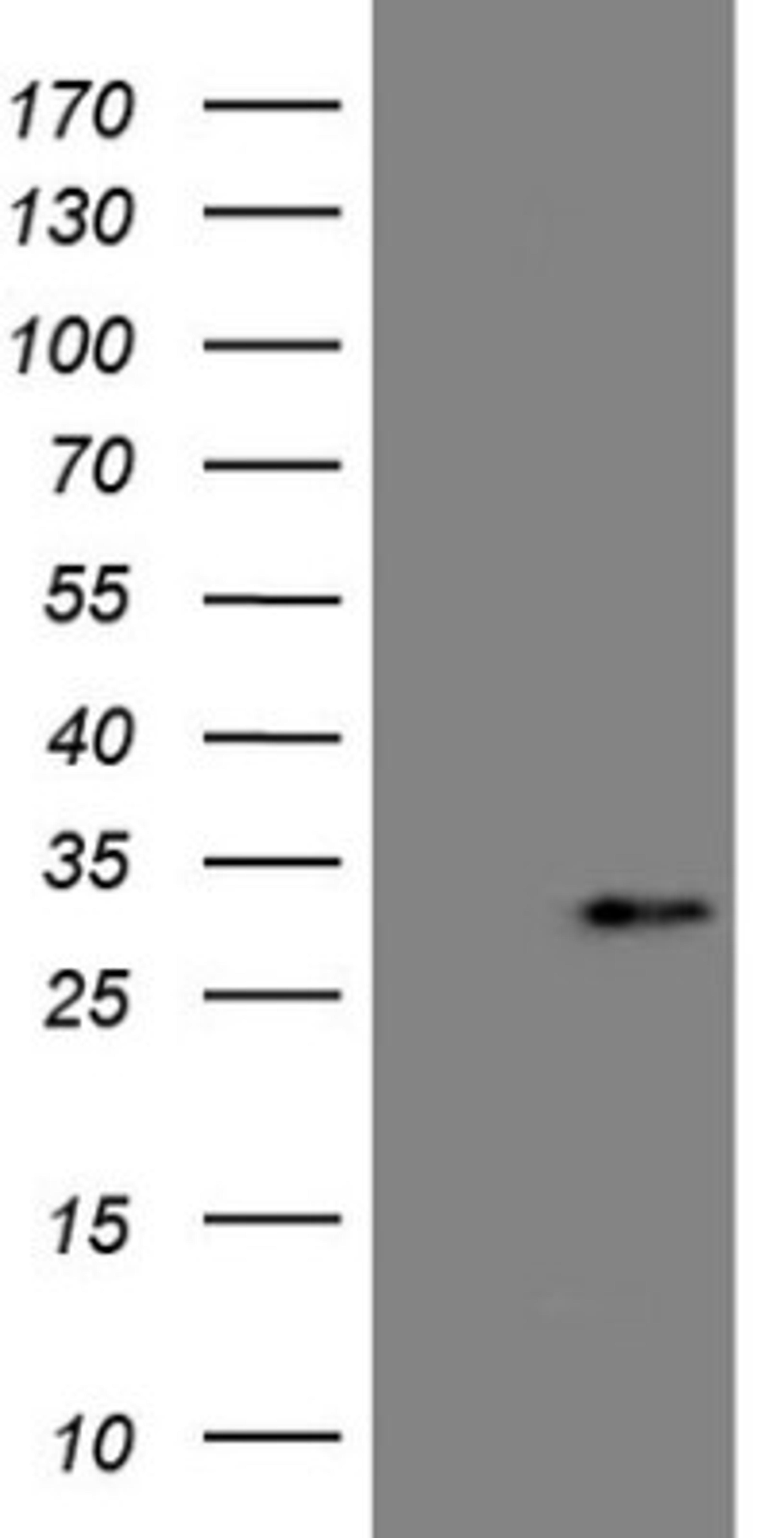 Western Blot: Angiopoietin-like protein 8/Betatrophin Antibody (1B12) [NBP2-46596] - Analysis of HEK293T cells were transfected with the pCMV6-ENTRY control (Left lane) or pCMV6-ENTRY Angiopoietin-like protein 8.