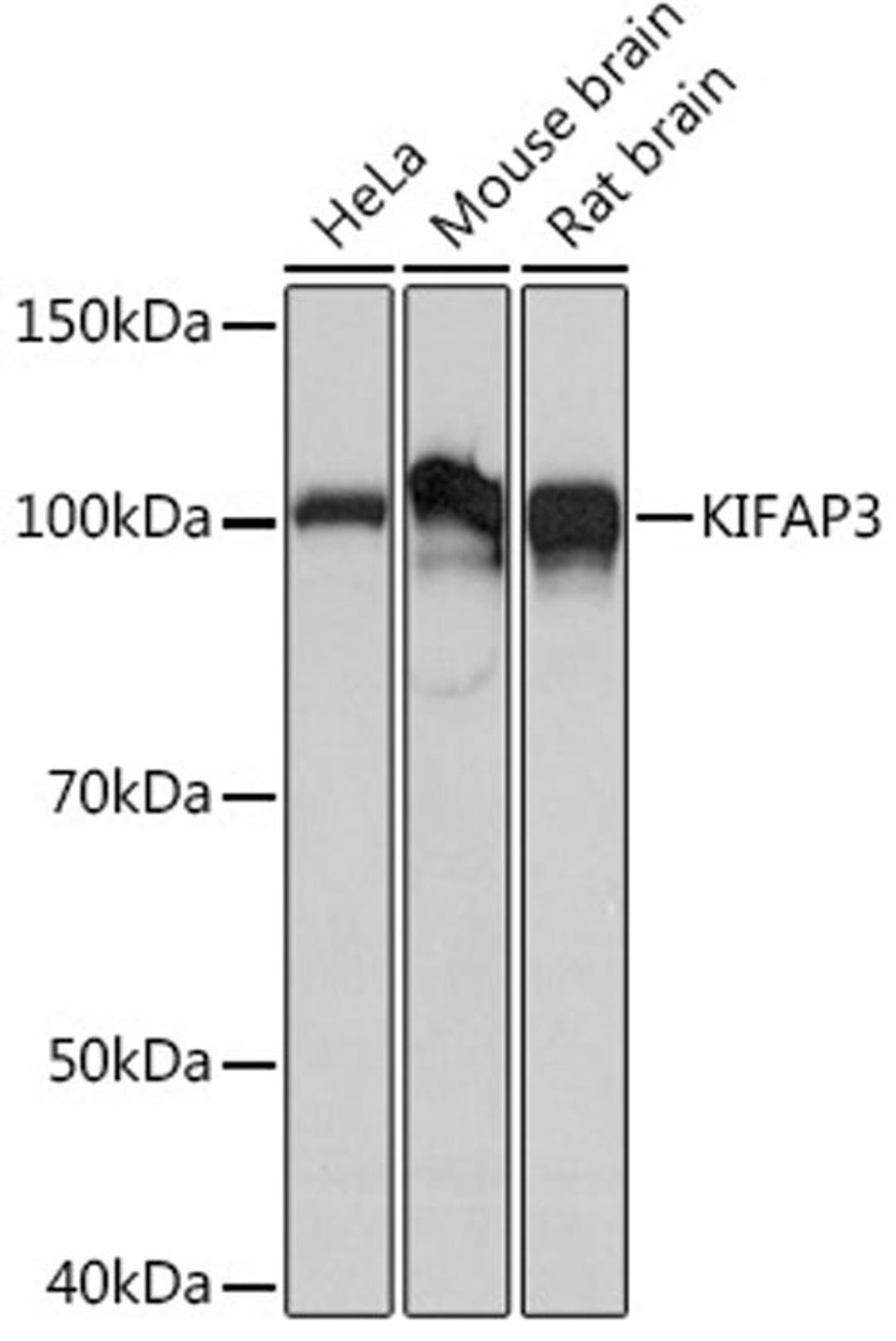 Western blot - KIFAP3 Rabbit mAb (A5216)