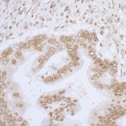 Detection of human LAP2 alpha beta gamma/TMPO by immunohistochemistry.