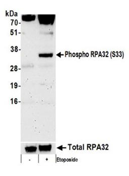 Detection of human Phospho RPA32 (S33) by western blot. Samples: Whole cell lysate (50 µg) from HeLa cells treated with 100 µM etoposide for 16 hours (+) or mock treated (-) cells.