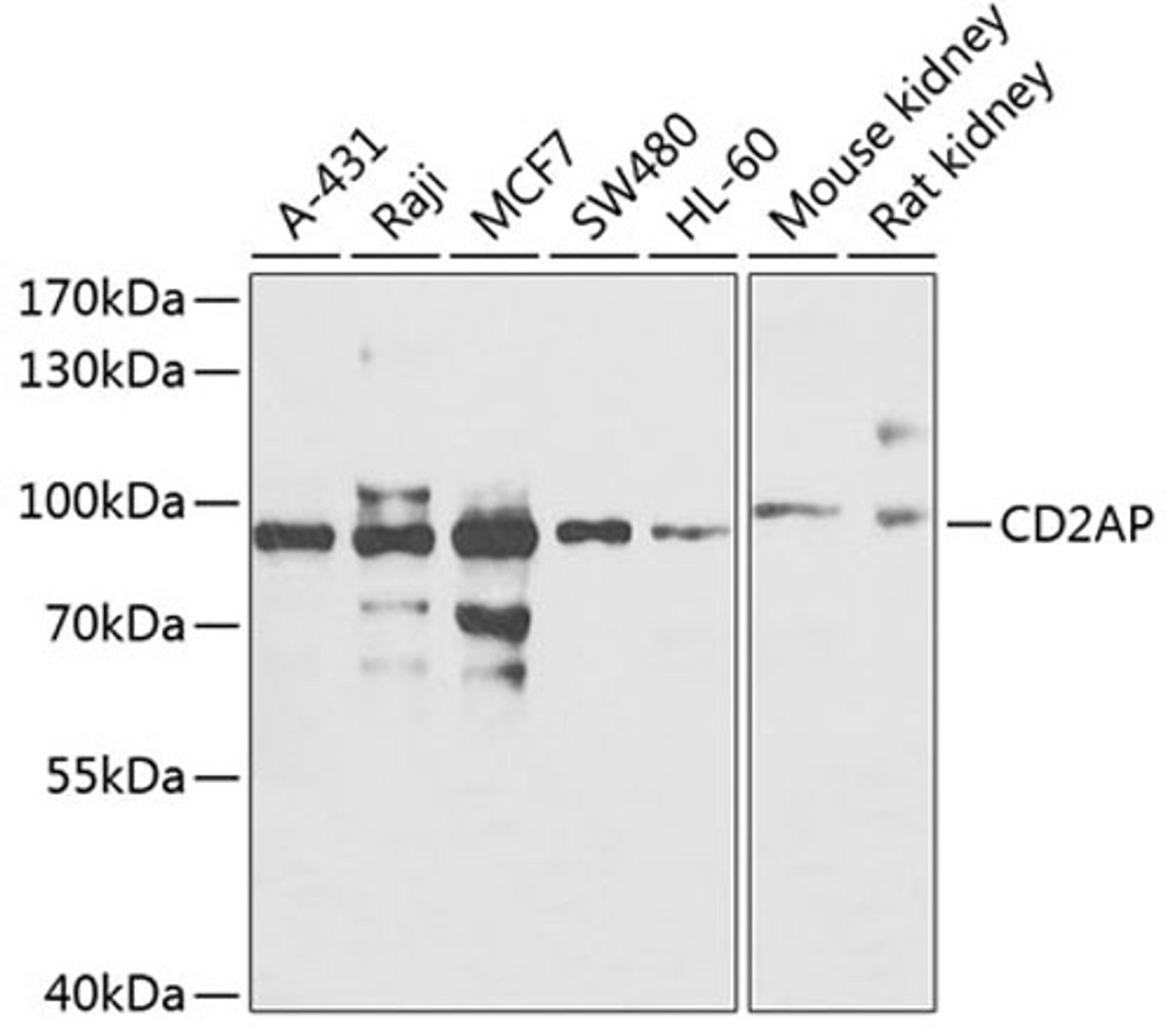 Western blot - CD2AP antibody (A7788)