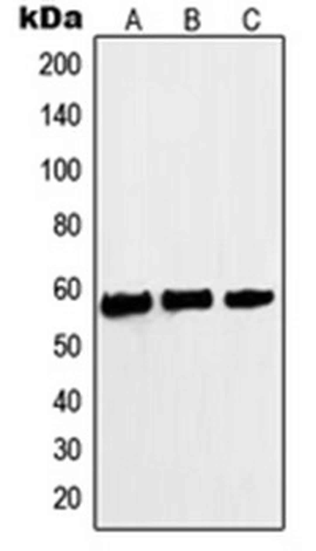 Western blot analysis of A431 (Lane 1), HeLa (Lane 2), Jurkat (Lane 3) whole cell lysates using MYC antibody