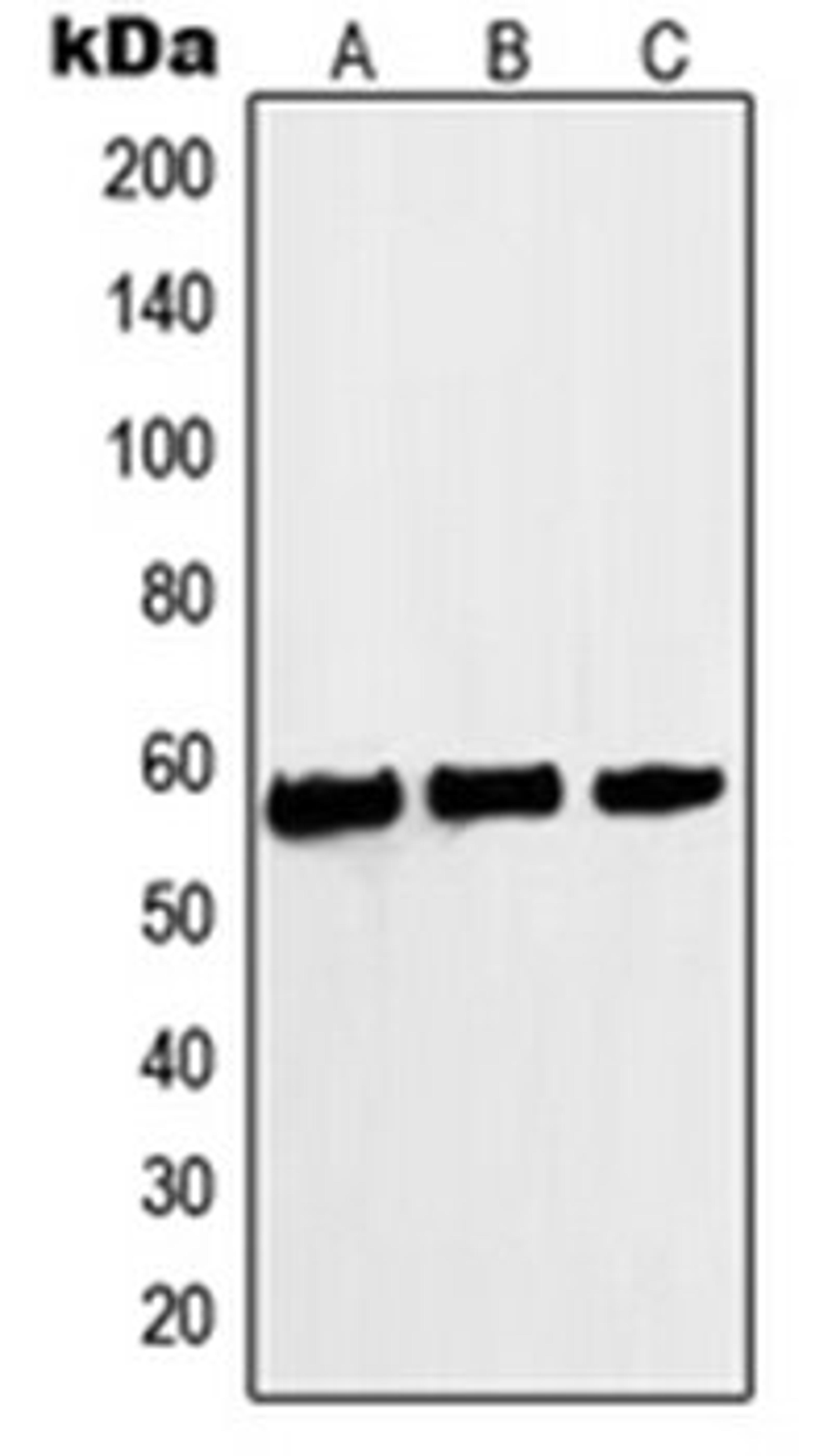 Western blot analysis of A431 (Lane 1), HeLa (Lane 2), Jurkat (Lane 3) whole cell lysates using MYC antibody