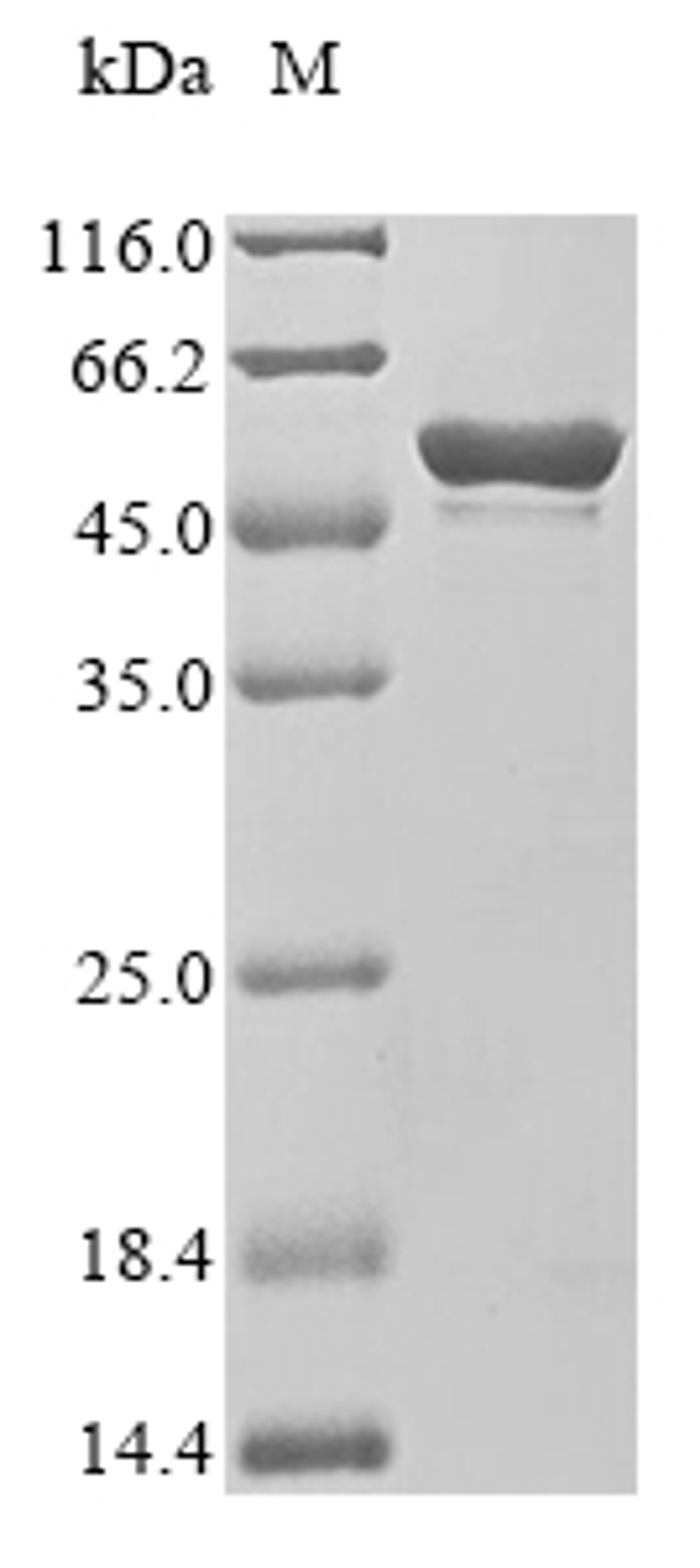 (Tris-Glycine gel) Discontinuous SDS-PAGE (reduced) with 5% enrichment gel and 15% separation gel.
