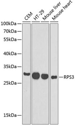 Western blot - RPS3 antibody (A13543)