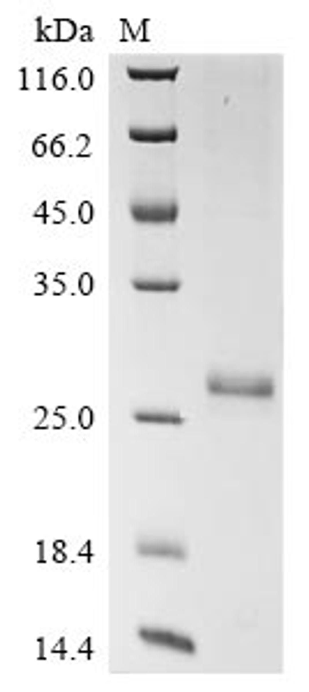 (Tris-Glycine gel) Discontinuous SDS-PAGE (reduced) with 5% enrichment gel and 15% separation gel.