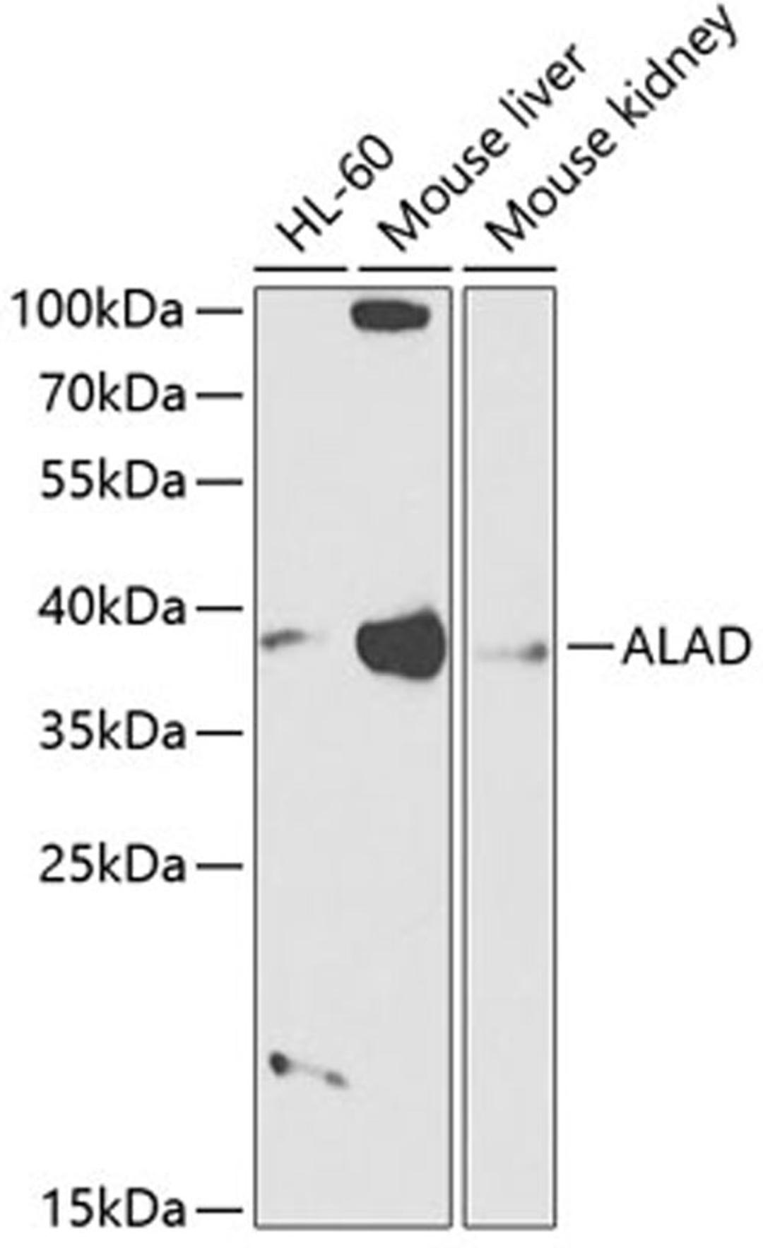 Western blot - ALAD antibody (A12395)