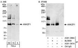 Detection of human ANKZF1 by western blot and immunoprecipitation.