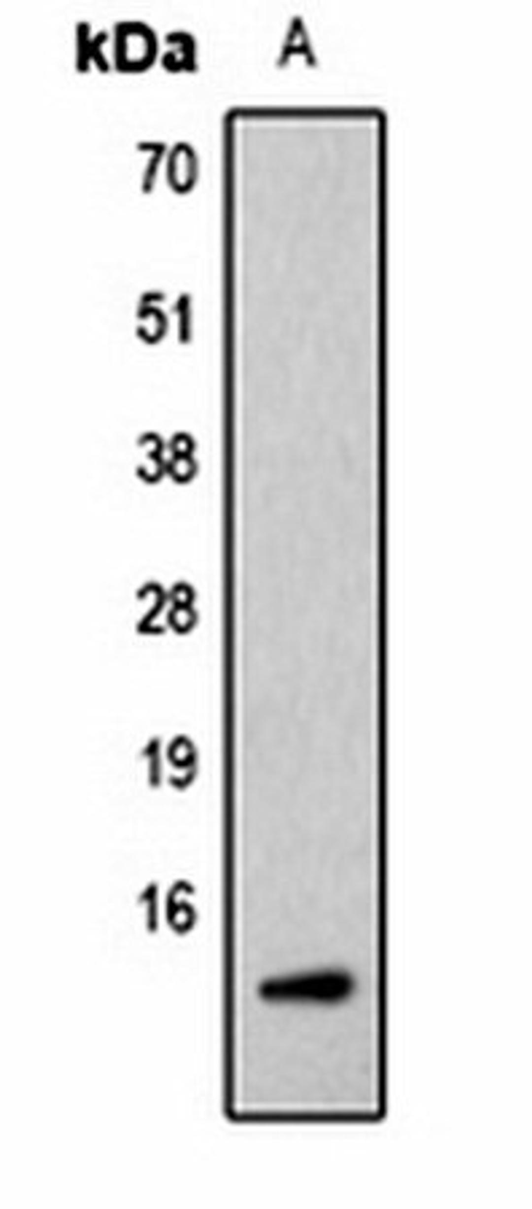 Western blot analysis of  Hela (Lane1) whole cell lysates using Histone H2B (AcK5) antibody