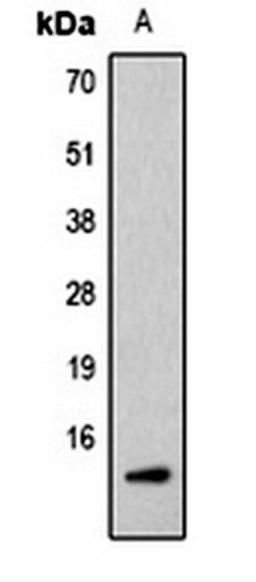 Western blot analysis of Hela (Lane1) whole cell lysates using Histone H2B (AcK5) antibody