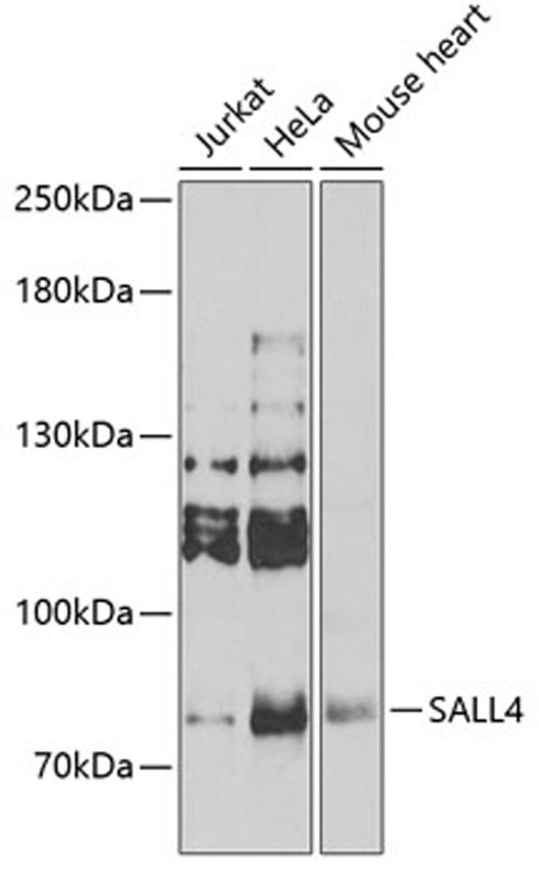 Western blot - SALL4 Antibody (A7124)