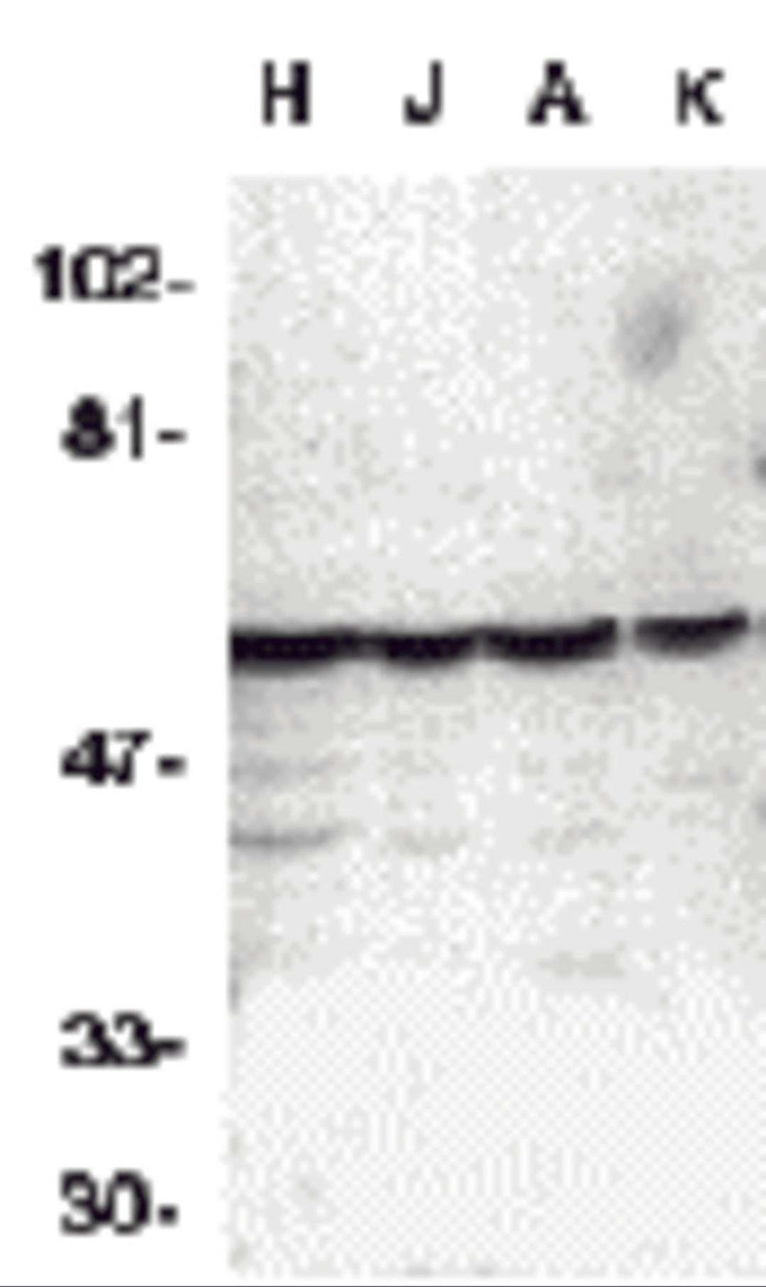 Western blot analysis of caspase-10 in HeLa (H), Jurkat (J), A431 (A), K562 (K) whole cell lysates with Caspase-10 antibody at 1 μg/mL.