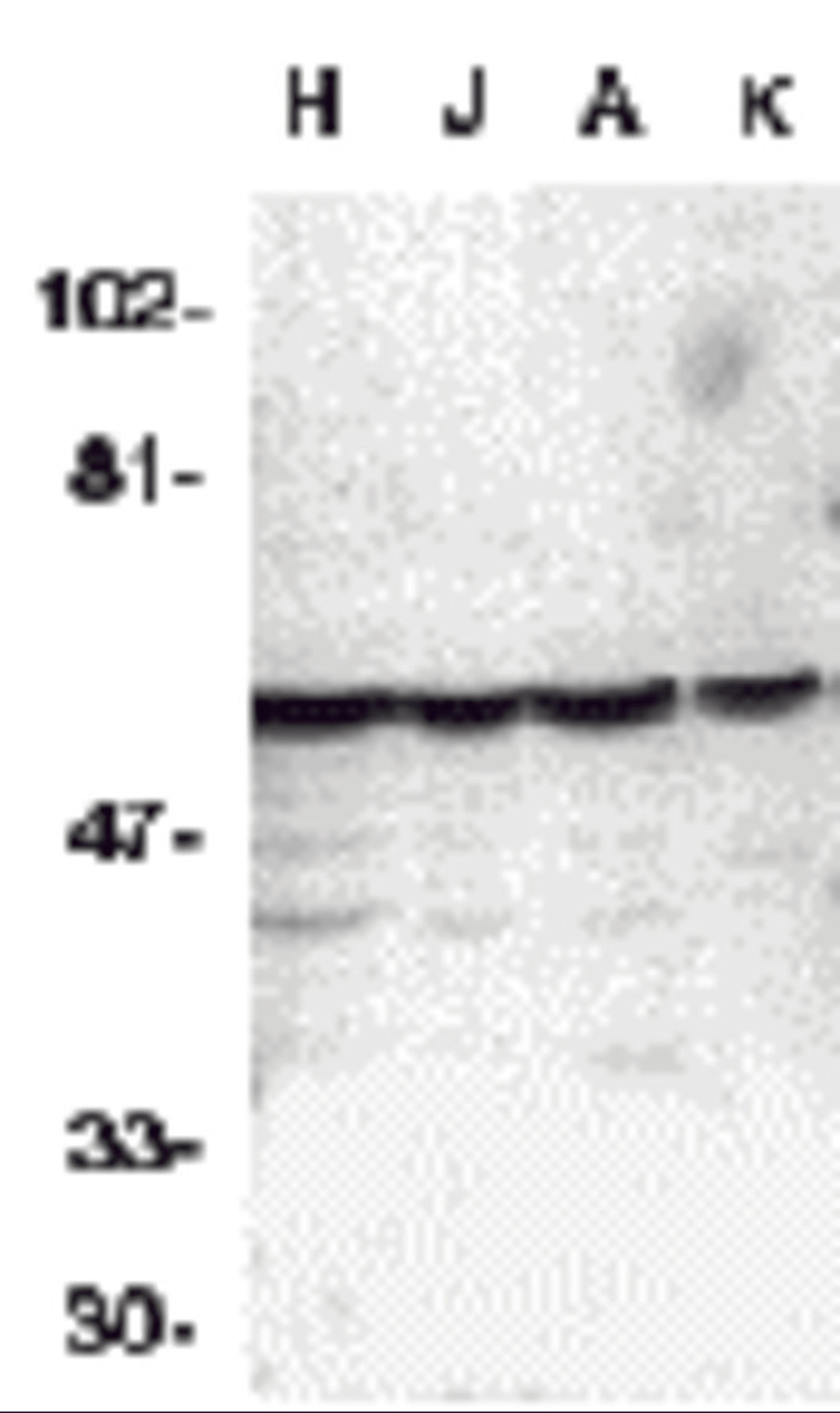Western blot analysis of caspase-10 in HeLa (H), Jurkat (J), A431 (A), K562 (K) whole cell lysates with Caspase-10 antibody at 1 μg/mL.