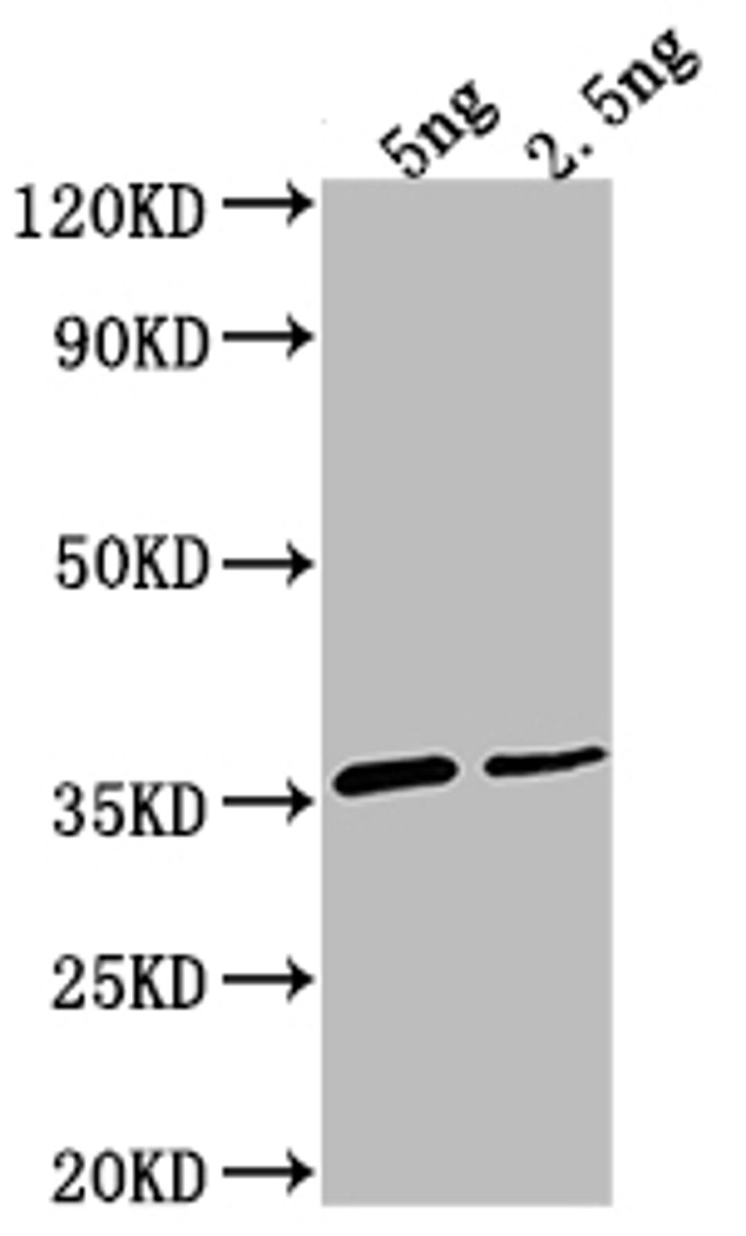 Western Blot. Positive WB detected in Recombinant protein. All lanes: D antibody at 1:2000. Secondary. Goat polyclonal to rabbit IgG at 1/50000 dilution. Predicted band size: 32.4 kDa. Observed band size: 35 kDa. 