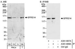 Detection of human SFRS14 by western blot and immunoprecipitation.