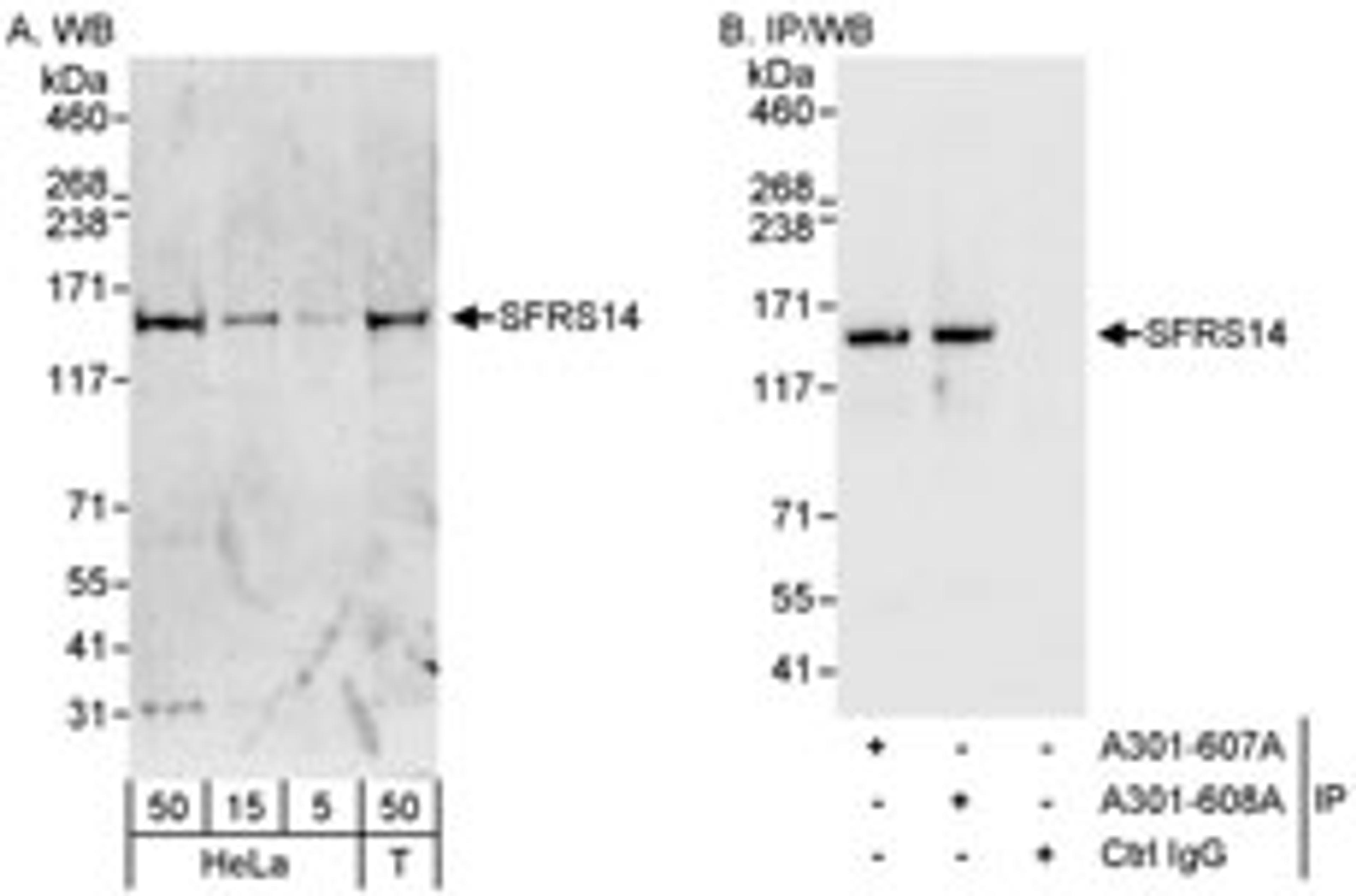 Detection of human SFRS14 by western blot and immunoprecipitation.