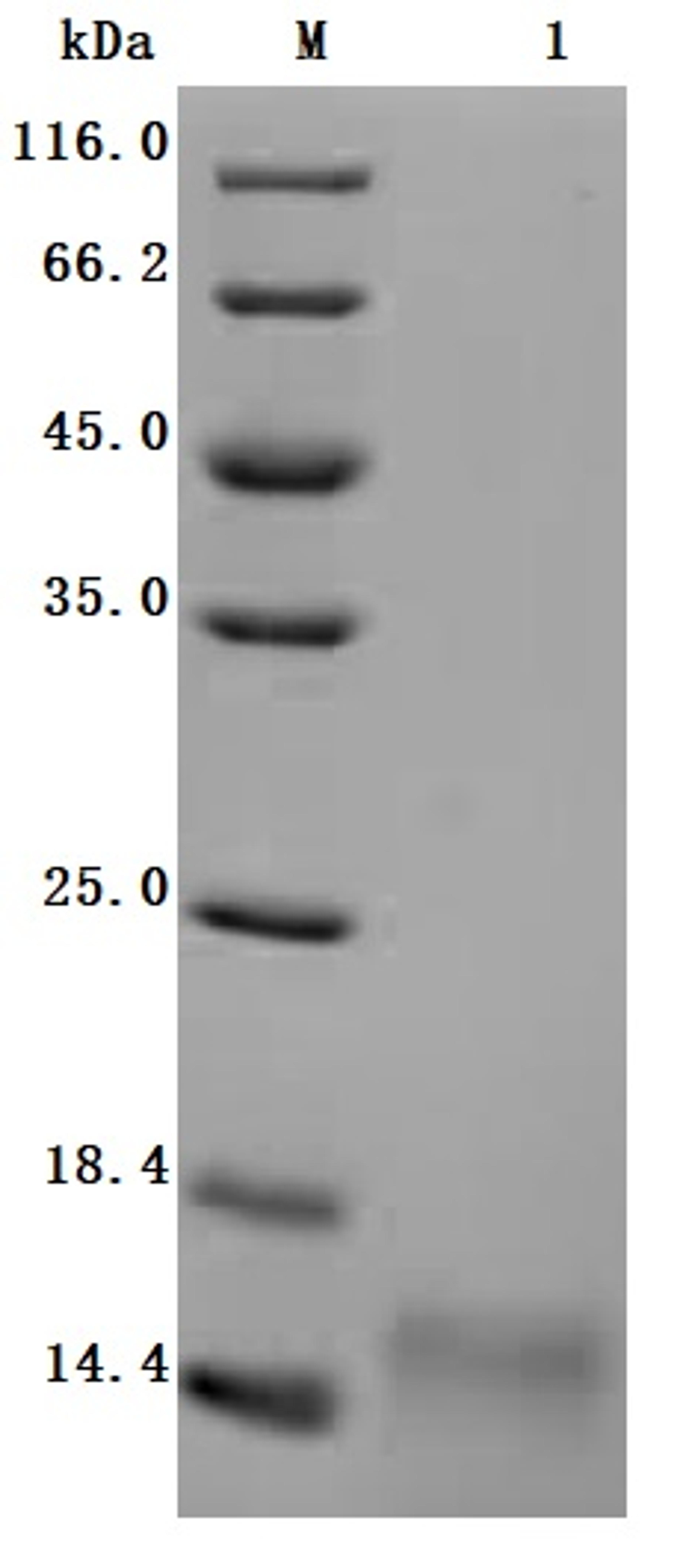 (Tris-Glycine gel) Discontinuous SDS-PAGE (reduced) with 5% enrichment gel and 15% separation gel.