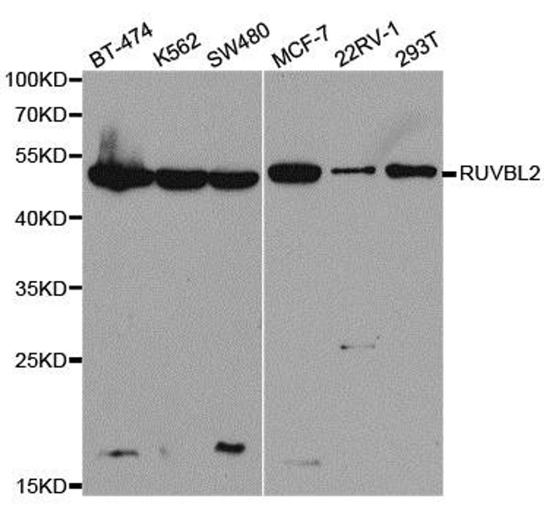 Western blot analysis of extracts of various cell lines using RUVBL2 antibody