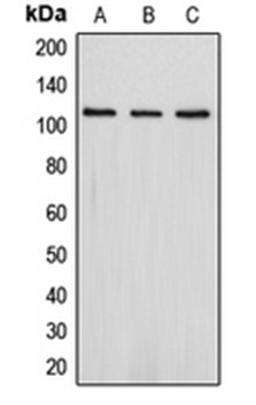 Western blot analysis of Jurkat (Lane 1), SHSY5Y (Lane 2), HepG2 (Lane 3) whole cell lysates using DLG2 antibody