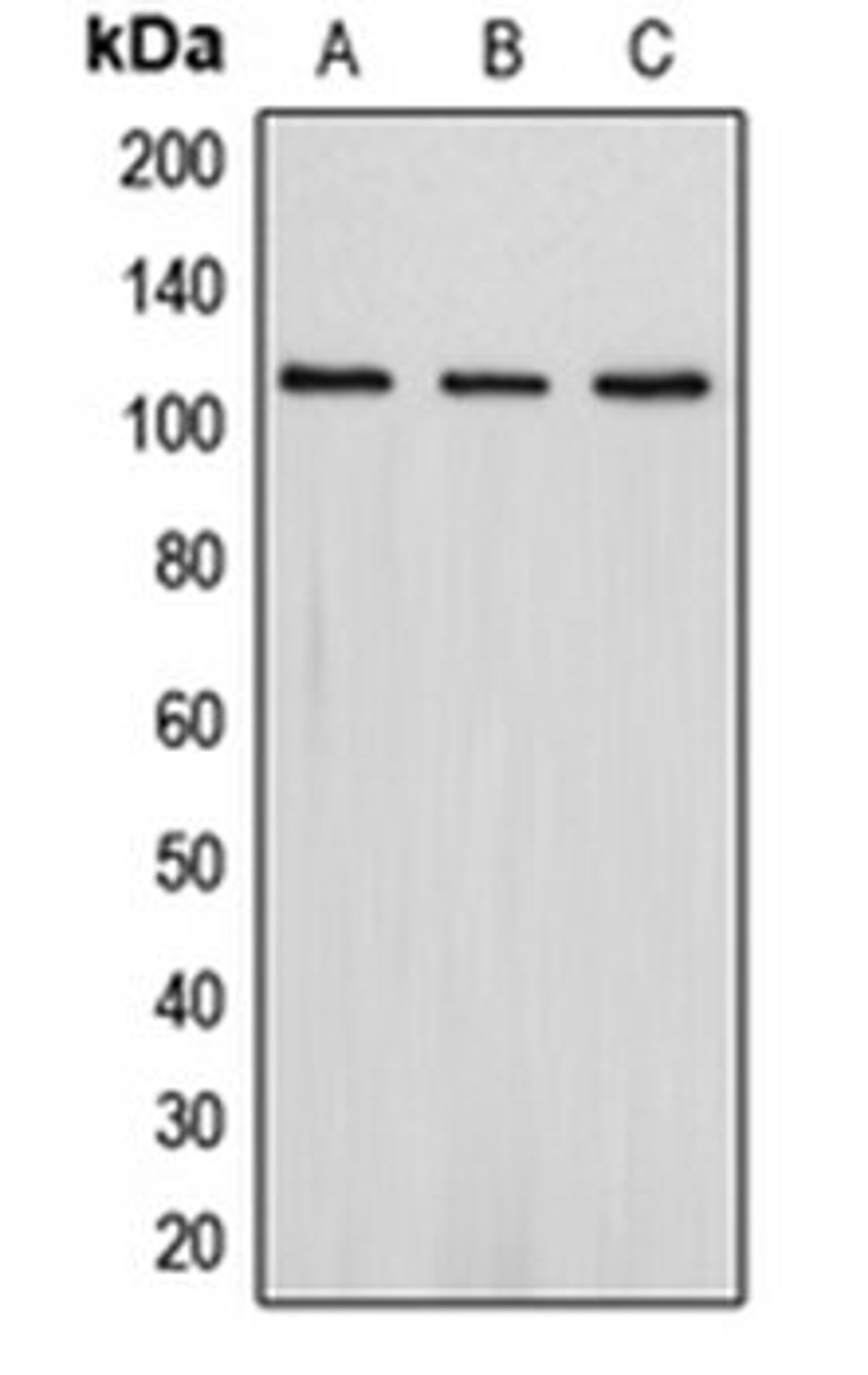 Western blot analysis of Jurkat (Lane 1), SHSY5Y (Lane 2), HepG2 (Lane 3) whole cell lysates using DLG2 antibody